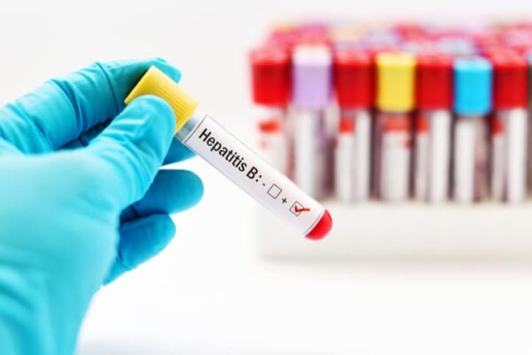 Quy trình xét nghiệm test nhanh Determine HBsAg