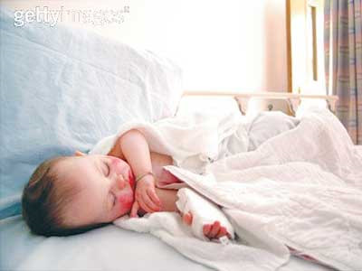 Tiêu chảy do Rotavirus