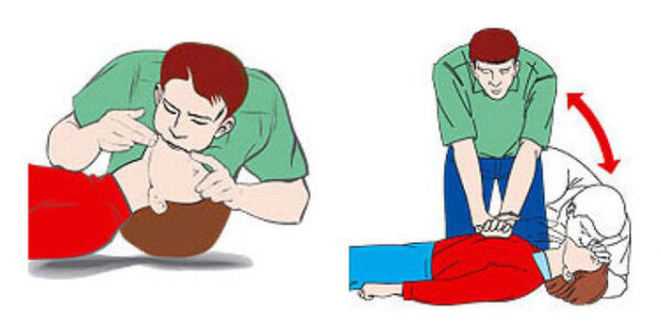 Kỹ thuật hô hấp nhân tạo