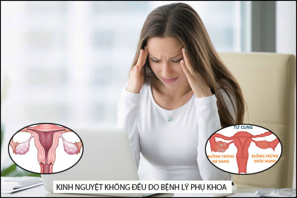 Lâm sàng bế kinh