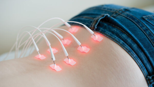 Quy trình Laser châm, xông ngâm thuốc, tác động cột sống