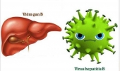 Hỗ trợ điều trị viêm gan bằng y học cổ truyền