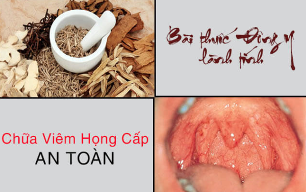 Một số bài thuốc trị viêm họng mùa lạnh