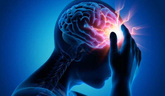 Vì sao nhiều người trẻ đột quỵ?