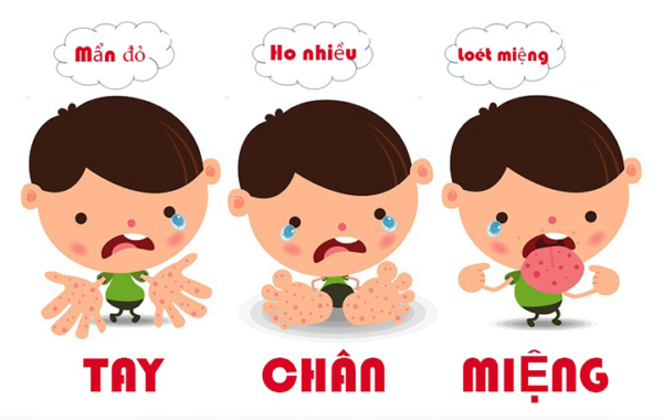 Trẻ mắc tay chân miệng kín các phòng bệnh