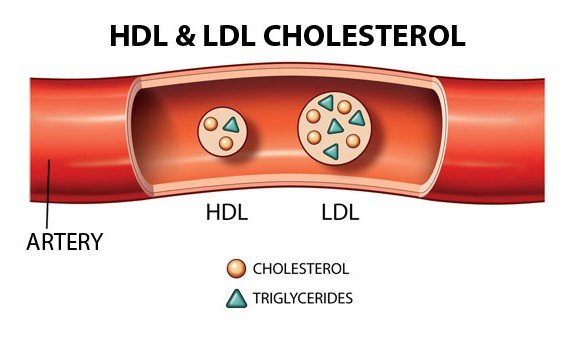 TỔNG QUAN VỀ TĂNG CHOLESTEROL TRONG MÁU
