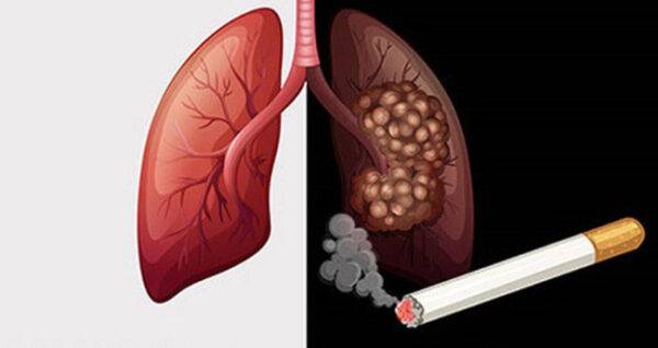 Thuốc lá cướp đi mạng sống của nhiều người hơn COVID-19
