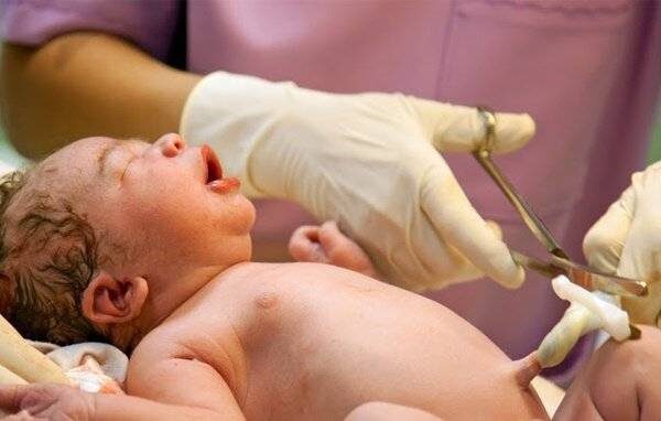 Sự thật về 3 phút “Vàng” trước khi cắt dây rốn cho con bố mẹ nào cũng cần phải biết