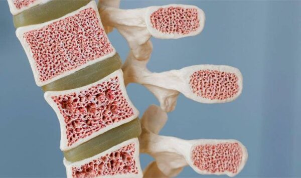 Sinh thiết tủy xương và chọc hút tủy xương