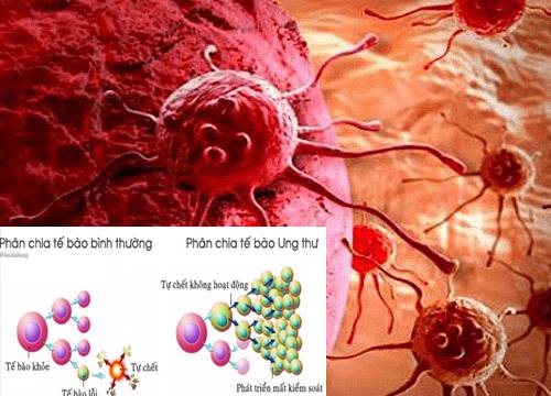 6 sai lầm thường gặp trong chế độ dinh dưỡng của người bệnh ung thư